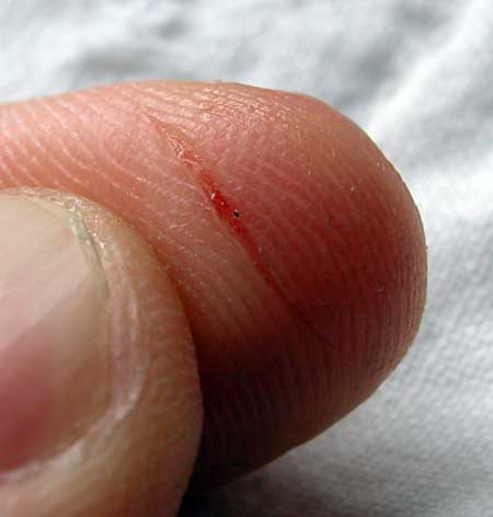 Cut finger